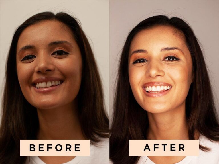 Ring Light Before and After